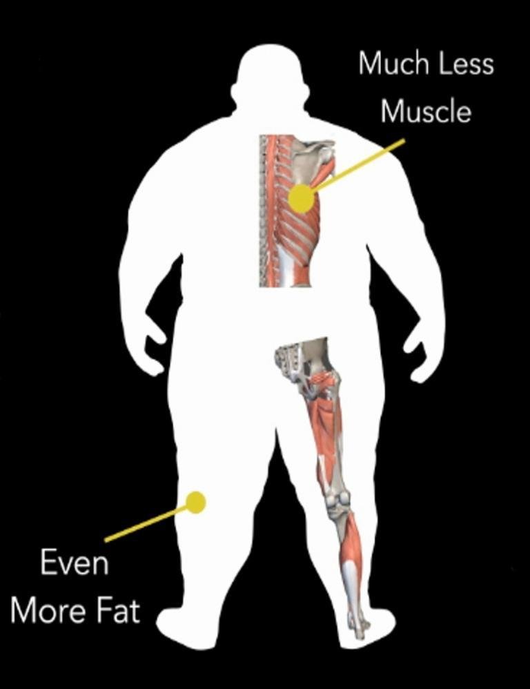 Understanding Body Type Three - Fellow One Research