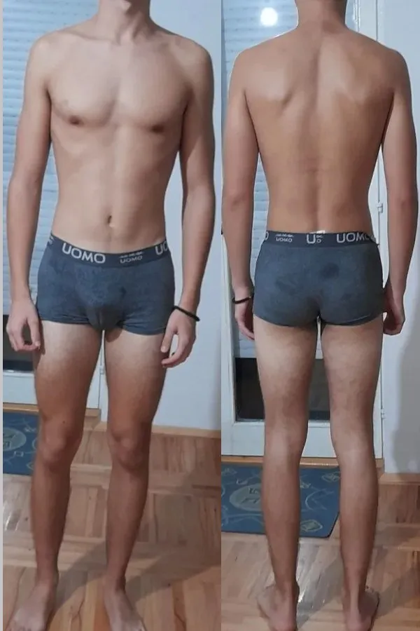 Body Type One, Muscles/Muscle Mass, Obesity, Skinny Fate