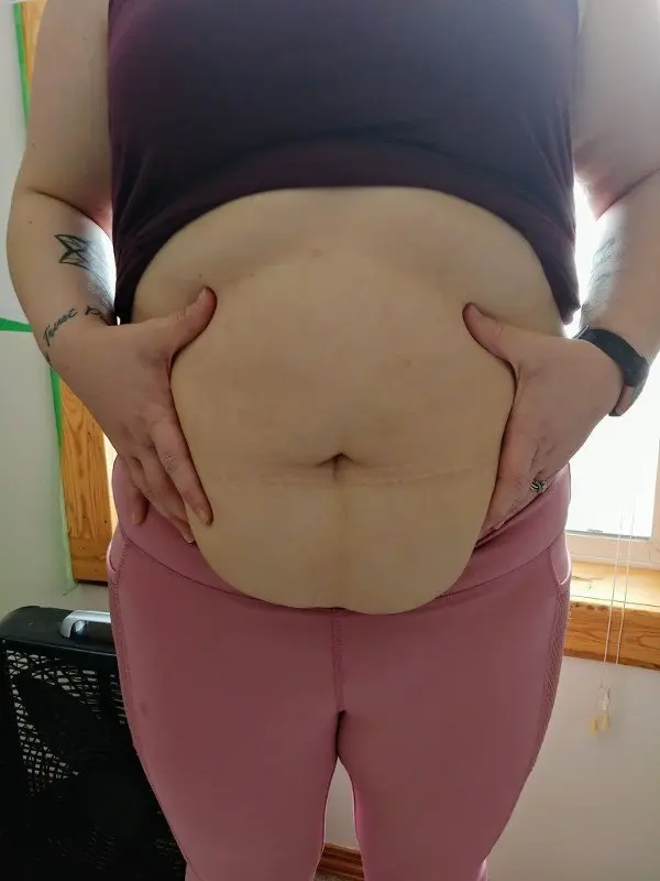 Research Participant: Best Exercise to Lose Belly Fat