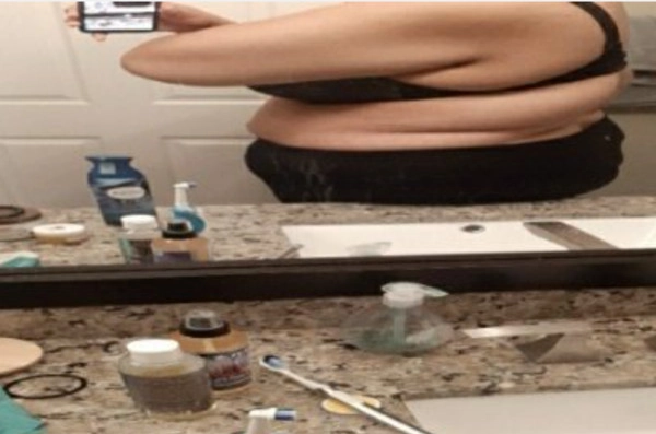 Research Participant 227 – Body Type Three (BT3) Female (Woman), Millennial (Generation Y)