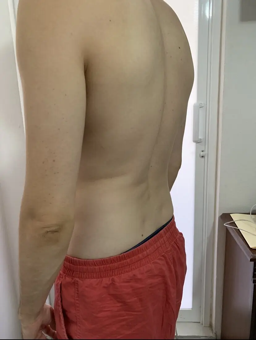 Research Participant 331 – Body Type Two (BT2) Male (Man), Millennial (Generation Y)