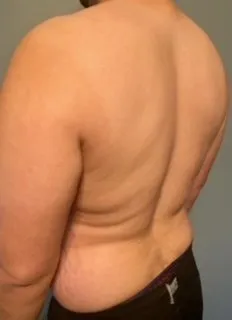 Research Participant 378 – Body Type Two (BT2) Male (Man), Millennial (Generation Y)