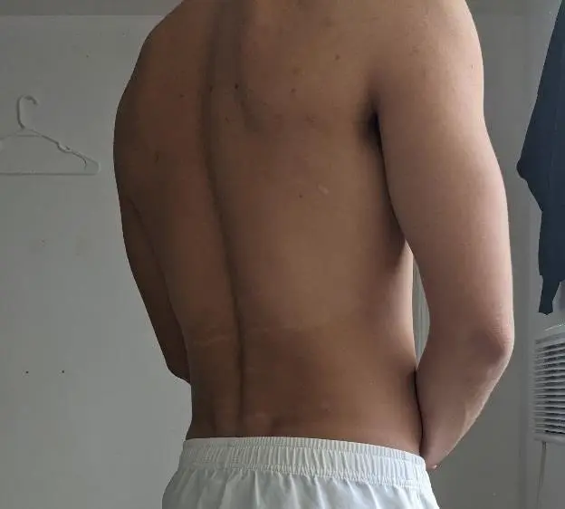 Research Participant 377 – Body Type One (BT1) Male (Man), Millennial (Generation Y)