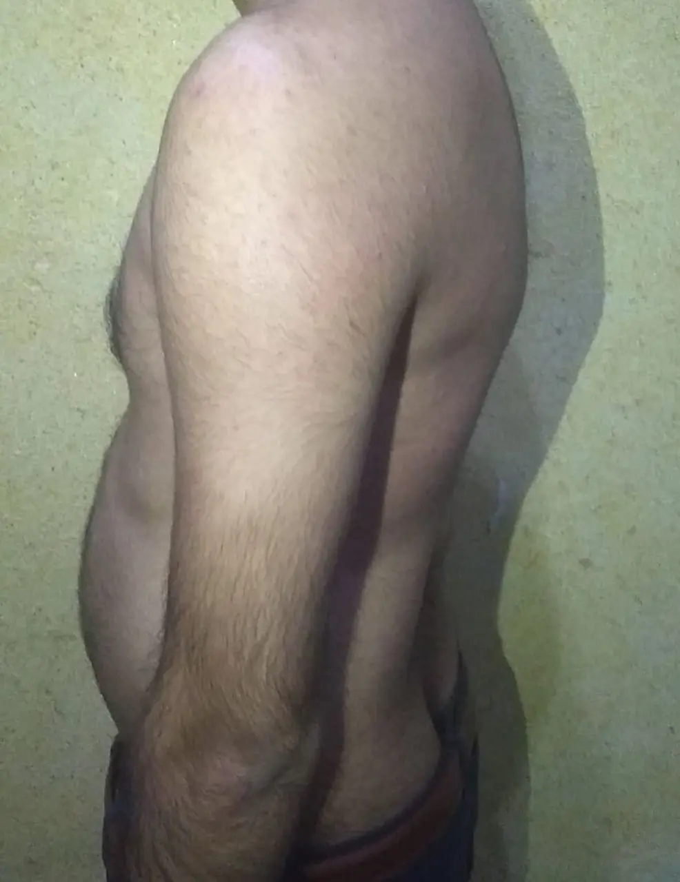 Research Participant 341 – Body Type Two (BT2) Male (Man), Generation Z