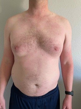 Research Participant 536 - Diary Day One - Abdominal-Midriff-Stomach