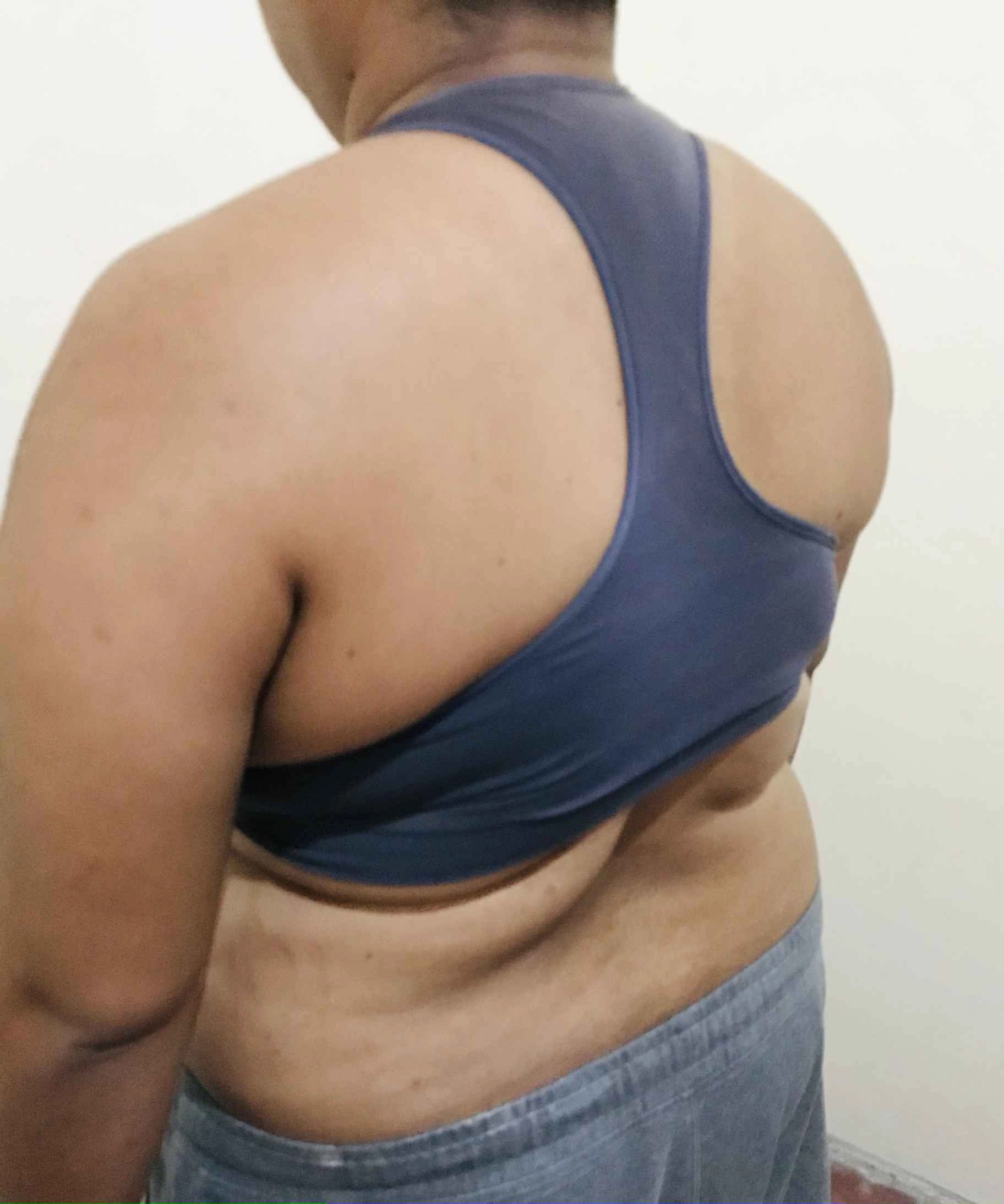 Research Participant 542 – Body Type Four (BT4) Female (Woman), Millennial (Generation Y)