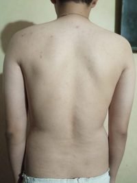 Body Type Two (BT2) Male - Fellow One Research Body Type Shape Test - The Four Body Types Research Participant 571