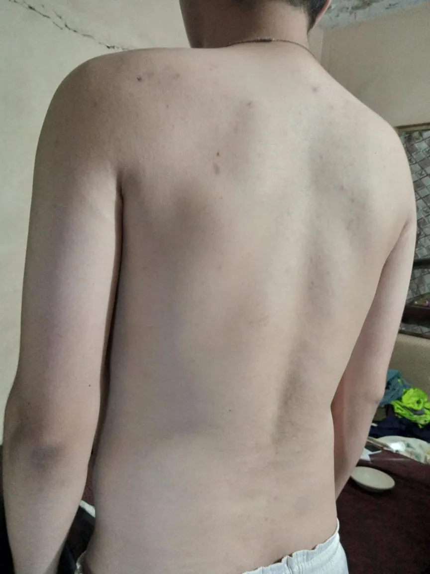 Research Participant 571 – Body Type Two (BT2) Male (Man), Generation Z