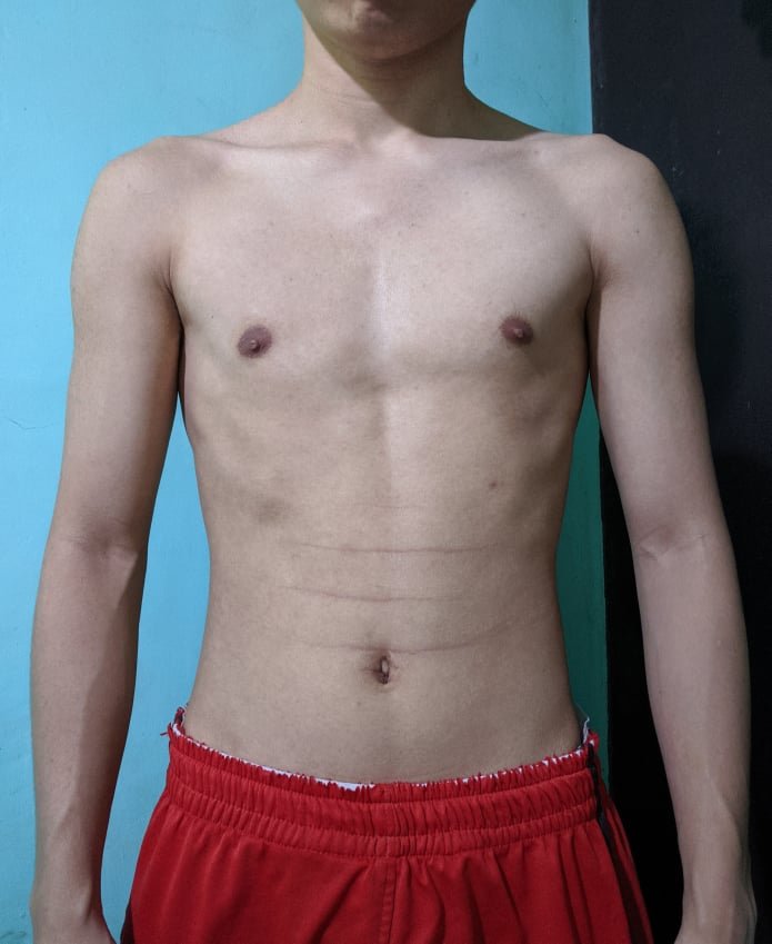 Body Type One (BT1) Male - Fellow One Research Body Type Shape Test - The Four Body Types Research Participant 667