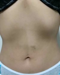 The Four Body Types, Fellow One Research Body Type Shape Quiz/Test - Body Type Two (BT2) Female - Research Participant 665