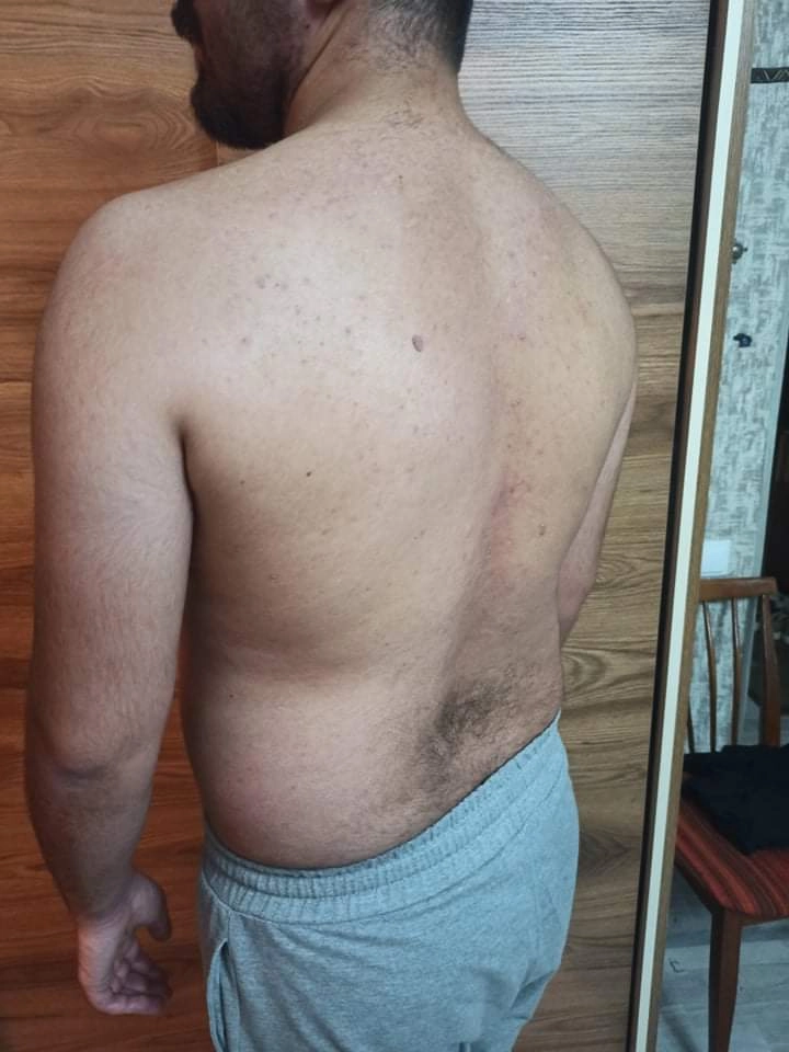 Research Participant 683 – Body Type Two (BT2) Male (Man), Millennial (Generation Y)