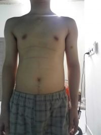 Body Type Test (Male/Men) Results 837, Body Type Two (BT2) - Fellow One Research Participant Quiz, The Four Body Types