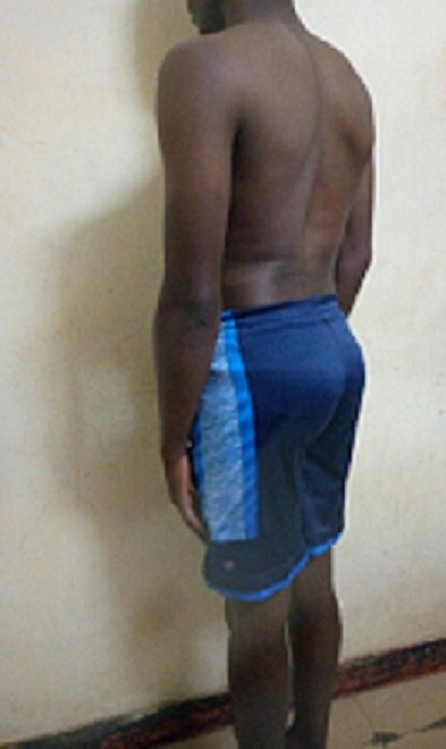 Body Type Test (Quiz) Results 849 – Body Type One (BT1) Male (Man), Generation Z Body Type Test (Quiz) Results 849 – Body Type One (BT1) Male (Man), Generation Z