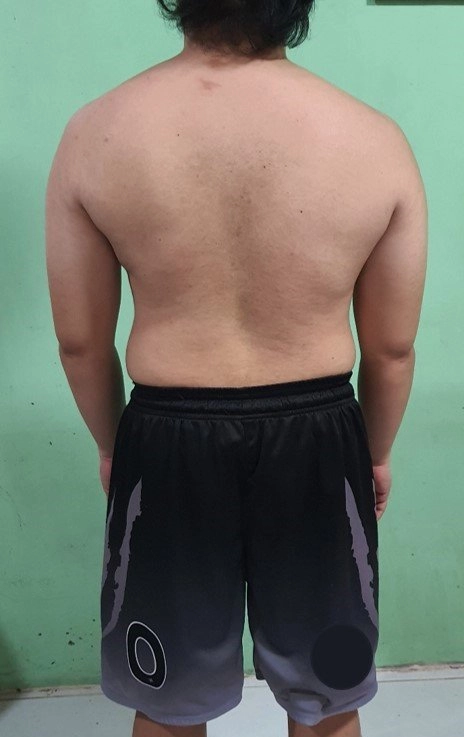 The Four (4) Body Types-Body Type Quiz (Male/Men/Man) Results 820, Body Type Two (BT2) - Fellow One Research Participant Test