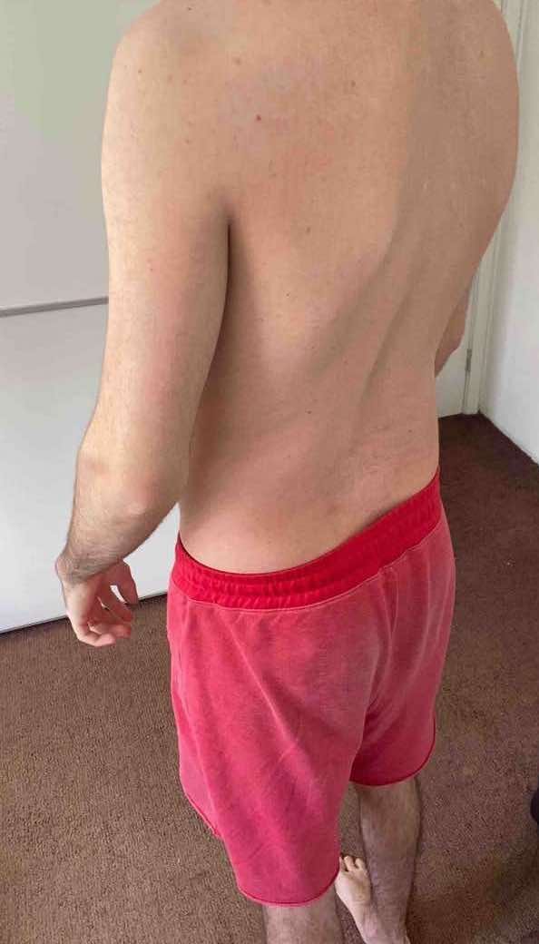 Body Type Test (Quiz) Results 865 – Body Type Two (BT2) Male (Man), Generation Z