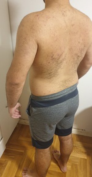 Body Type Test (Quiz) Results 925 – Body Type Two (BT2) Male (Man), Millennial (Generation Y)