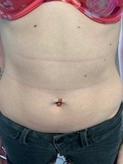 The Four Body Types - Body Type Test/Quiz (Female/Woman) Results 866 - Fellow One Research Participant, Body Type Two (BT2)