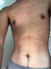 Body Type Quiz (Man/Male/Men) Results 888, Fellow One Research - The Four (4) Body Types Test, Body Type Two (BT2)