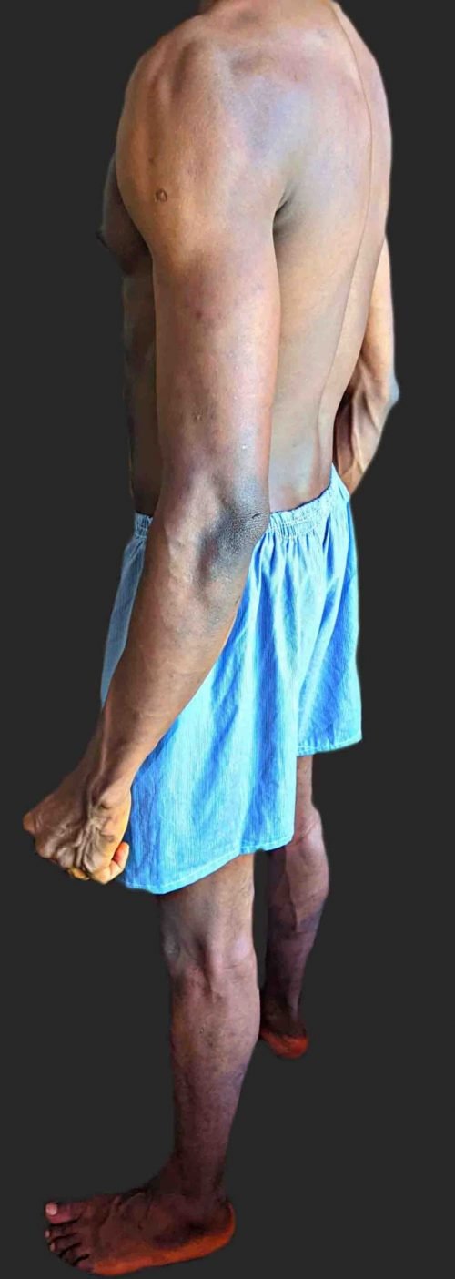 Body Type Test (Quiz) Results 967 – Body Type One (BT1) Male (Man), Millennial (Generation Y)