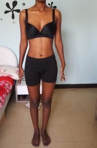 Body Type Test (Female/Woman) Results 1037, Body Type One (BT1) - Fellow One Research Participant Quiz, The Four Body Types