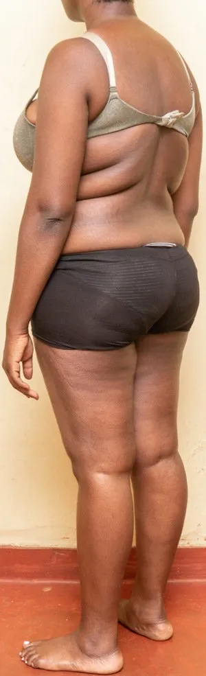 Body Type Test (Quiz) Results 1368 – Body Type Three (BT3) Female (Woman), Millennial (Generation Y)