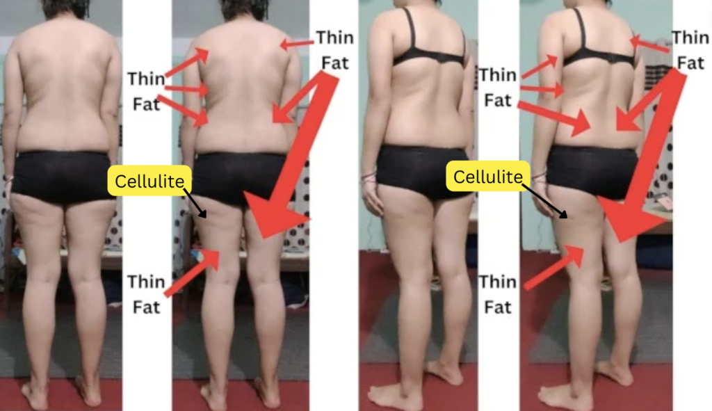 Skinny Fat - Thin Fat & Cellulite