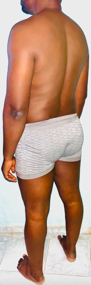 Body Type Test (Quiz) Results 1443 – Body Type Three (BT3) Male (Man), Millennial (Generation Y)